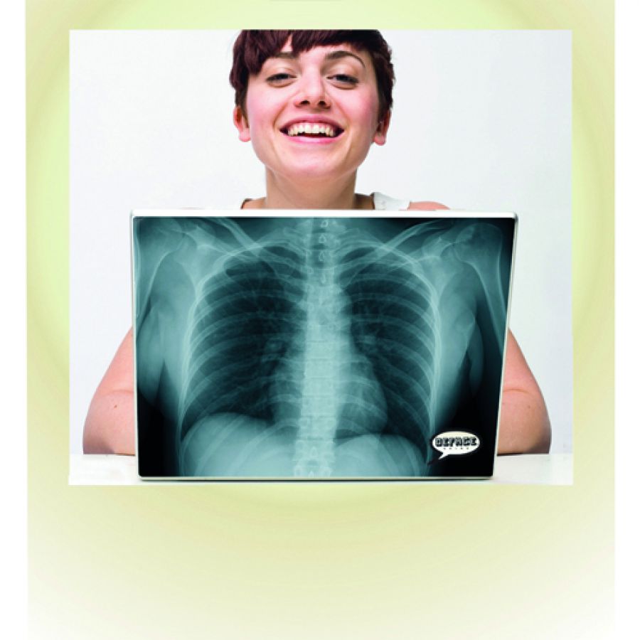 Nalepka na laptopa X-Ray